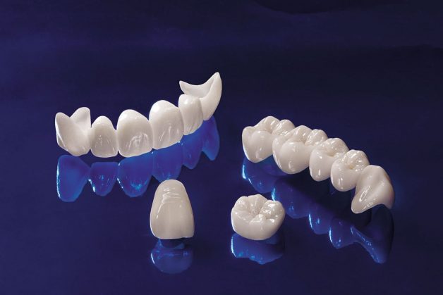 Độ bền của răng sứ Cercon được bao lâu?