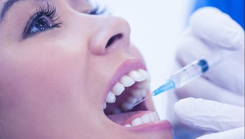 Tìm hiểu về gây tê khi nhổ răng | Nhổ răng Cần Thơ
