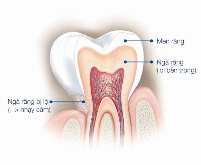 Nguyên nhân khiến ngà răng bị lộ | Nha Khoa Cần Thơ