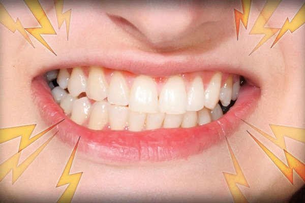 Làm thế nào để hết nghiến răng cả ngày lẫn đêm? Nha Khoa Cần Thơ