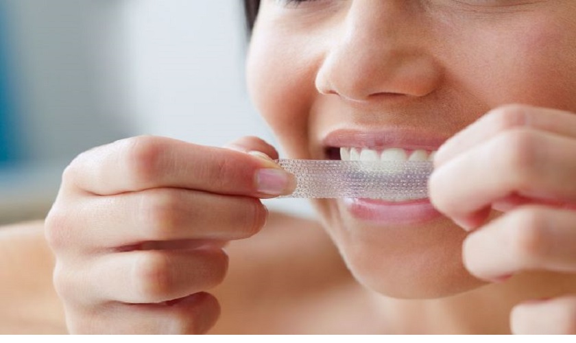 Cách sử dụng miếng dán trắng răng đơn giản và hiệu quả nhất
