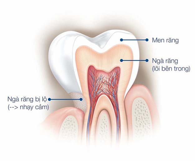 Tại sao men răng lại bị hư tổn? Nha Khoa Cần Thơ