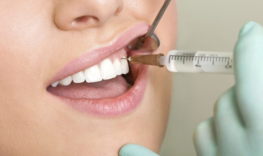 Trám răng có cần thuốc tê không? Trám răng Cần Thơ