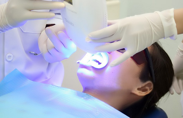 Kiến thức về tẩy trắng răng bằng Laser | Tẩy trắng răng Cần Thơ
